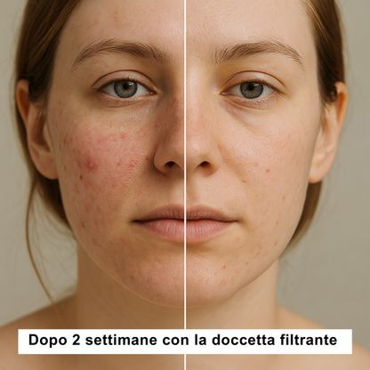 doccetta filtrante