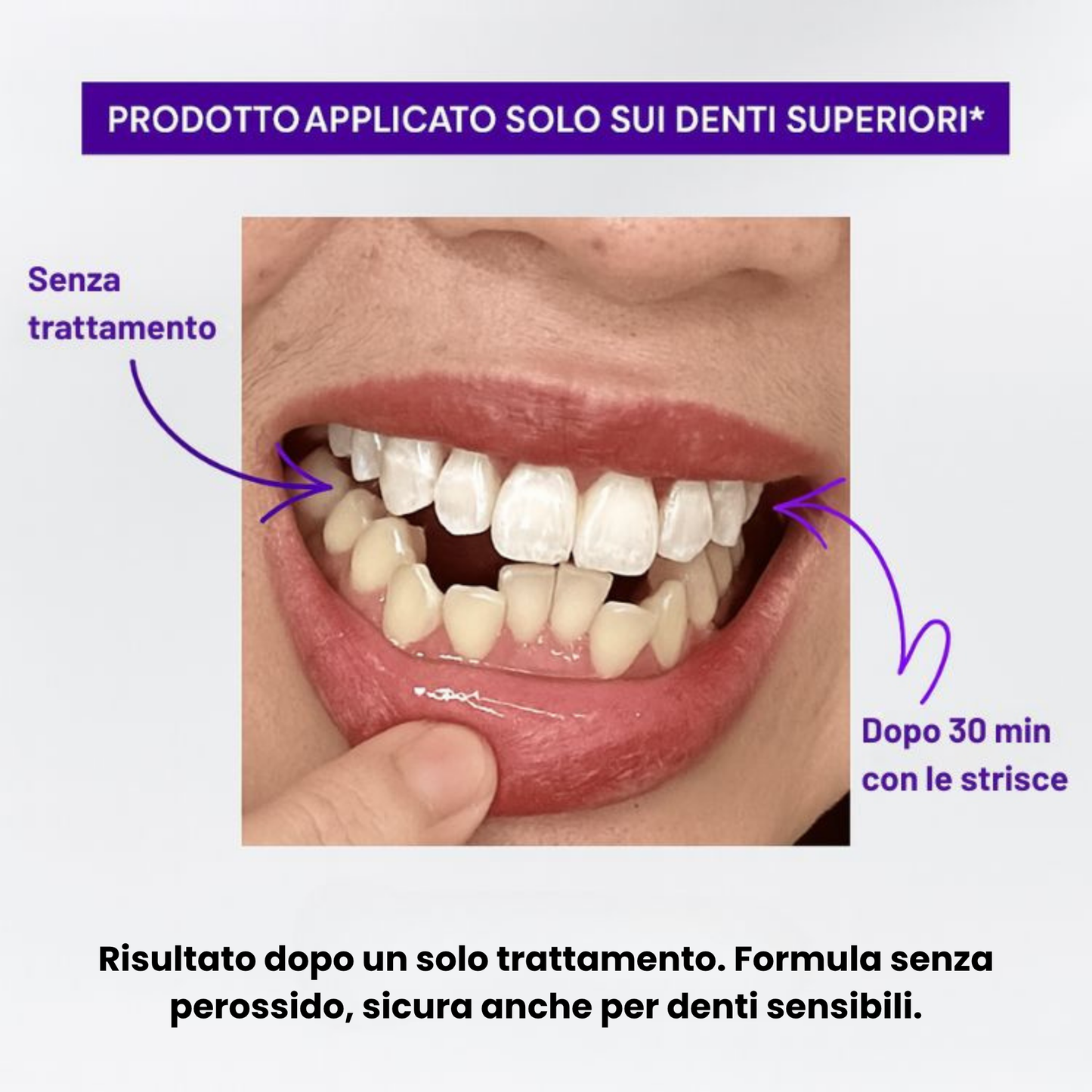 Teeth Whitening Strips